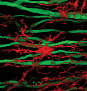 טיפול ב"קופקסון" גורם לתאים מייצרי המיאלין (צבועים באדום) לנדוד אל האזורים הפגועים ולהצטבר בקרבת תאי העצב (צבועים בירוק)